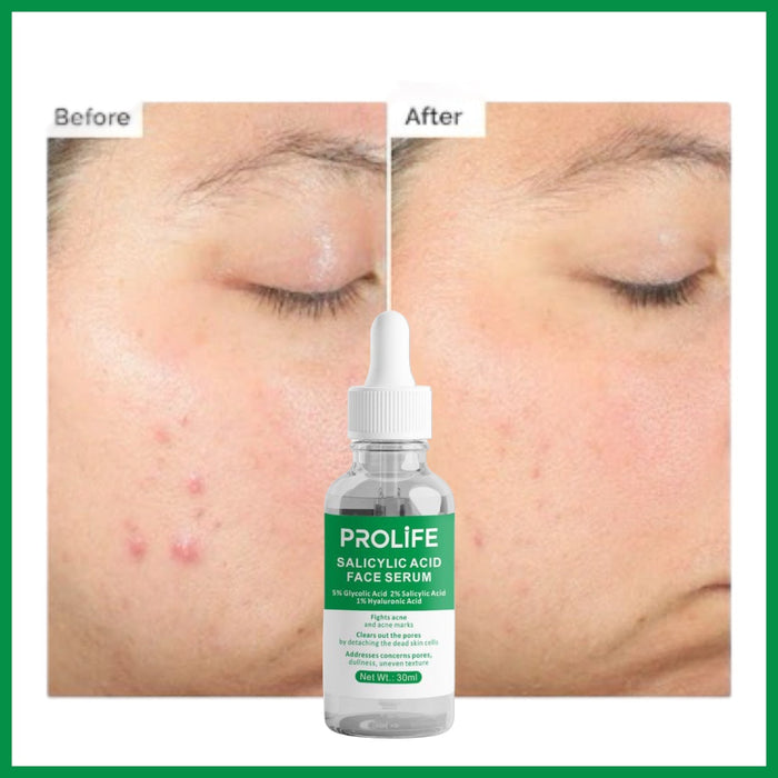 Salicylic Acid Face Serum